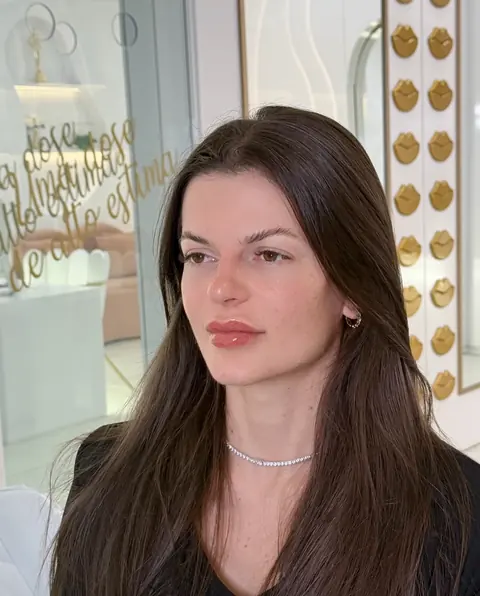 Depois da harmonização facial